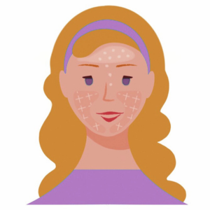 Combination Skin Type, oily and dry simultaneously